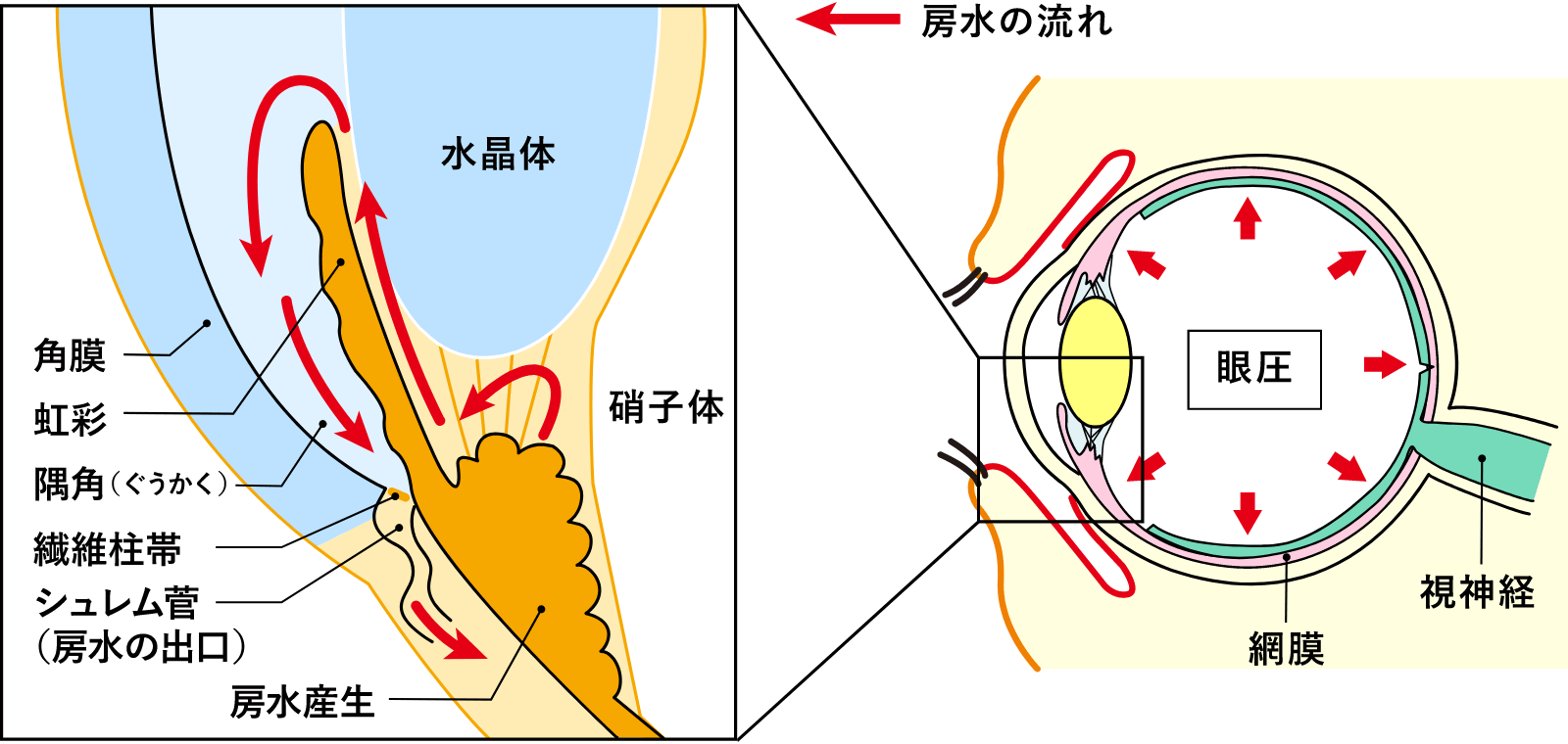 緑内障