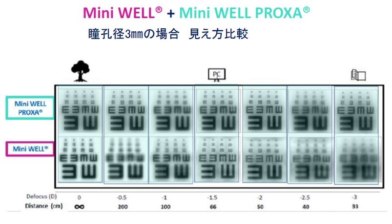 Mini WELL Ready（ミニウエル レディー）Mini WELL PROXA（ミニウエル プロクサ）瞳孔径3mmの場合の見え方比較