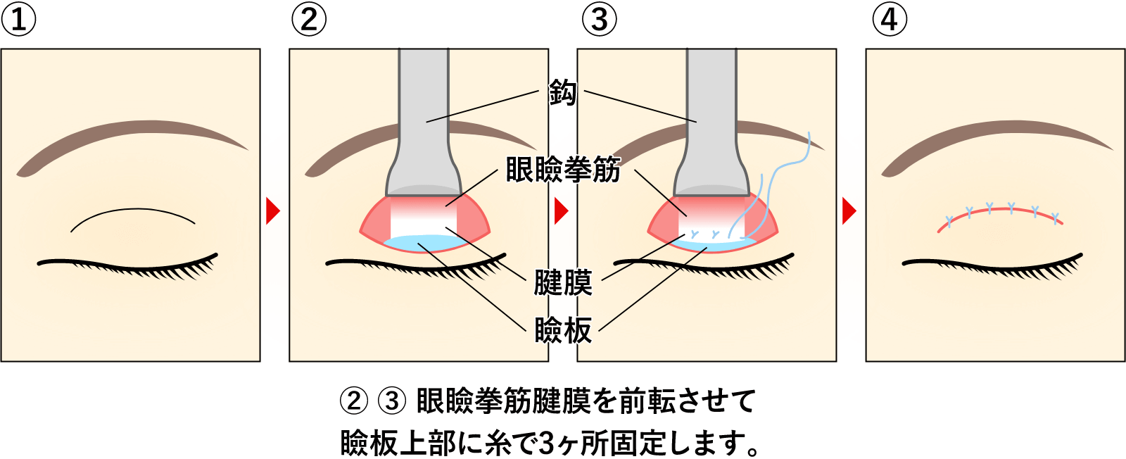 治療