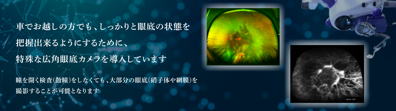 特殊な広角眼底カメラを導入しています。